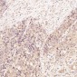 Anti-EpCAM/Trop1 Rabbit Monoclonal Antibody
