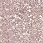 Anti-EpCAM/Trop1 Rabbit Monoclonal Antibody