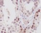 Anti-NUP98 Rabbit Monoclonal Antibody