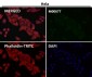 Anti-PLCG1/Plc Gamma 1 Rabbit Monoclonal Antibody