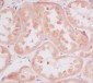 Anti-RPS20/Ribosomal Protein S20 Rabbit Monoclonal Antibody