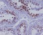 Anti-CD168 HMMR Rabbit Monoclonal Antibody