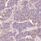 Anti-CD168 HMMR Rabbit Monoclonal Antibody