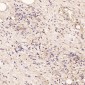Anti-CD168 HMMR Rabbit Monoclonal Antibody