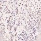Anti-CD168 HMMR Rabbit Monoclonal Antibody