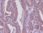 Anti-MEKK2 MAP3K2 Rabbit Monoclonal Antibody