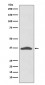 Anti-EpCAM/Trop1 Rabbit Monoclonal Antibody