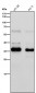 Anti-EpCAM/Trop1 Rabbit Monoclonal Antibody