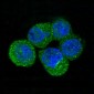 Anti-S100P Rabbit Monoclonal Antibody