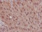 Anti-S100P Rabbit Monoclonal Antibody