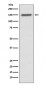 Anti-ASPP2 Rabbit Monoclonal Antibody