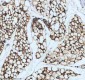 Anti-FABP4/A Fabp Rabbit Monoclonal Antibody