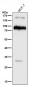 Anti-L1CAM Rabbit Monoclonal Antibody