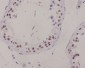 Anti-XRCC1 Rabbit Monoclonal Antibody