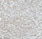 Anti-53BP1 TP53BP1 Rabbit Monoclonal Antibody