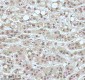 Anti-53BP1 TP53BP1 Rabbit Monoclonal Antibody