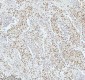 Anti-53BP1 TP53BP1 Rabbit Monoclonal Antibody