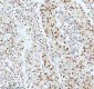 Anti-53BP1 TP53BP1 Rabbit Monoclonal Antibody