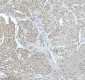 Anti-53BP1 TP53BP1 Rabbit Monoclonal Antibody