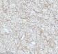 Anti-53BP1 TP53BP1 Rabbit Monoclonal Antibody