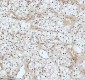 Anti-53BP1 TP53BP1 Rabbit Monoclonal Antibody