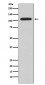 Anti-NFAT2 NFATC1 Rabbit Monoclonal Antibody
