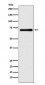 Anti-EAAT2/GLT-1/SLC1A2 Rabbit Monoclonal Antibody