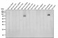Anti-BACE1/Bace Rabbit Monoclonal Antibody