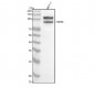 Anti-FGFR4 Rabbit Monoclonal Antibody
