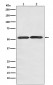 Anti-GLUT3 SLC2A3 Rabbit Monoclonal Antibody