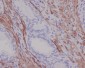 Anti-Desmin Rabbit Monoclonal Antibody