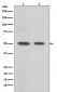 Anti-Desmin Rabbit Monoclonal Antibody