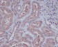 Anti-HAPLN1 Rabbit Monoclonal Antibody
