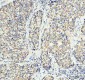Anti-TOMM20/Tom20 Rabbit Monoclonal Antibody