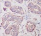 Anti-RALBP1 Rabbit Monoclonal Antibody
