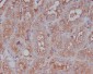 Anti-Moesin Rabbit Monoclonal Antibody