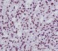 Anti-FANCD2 Rabbit Monoclonal Antibody