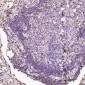 Anti-S100A4 Rabbit Monoclonal Antibody