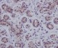 Anti-STAT5b Rabbit Monoclonal Antibody