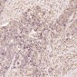 Anti-TSG101 Rabbit Monoclonal Antibody
