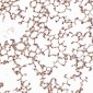 Anti-TSG101 Rabbit Monoclonal Antibody