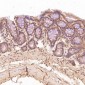 Anti-TSG101 Rabbit Monoclonal Antibody