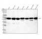 Anti-TSG101 Rabbit Monoclonal Antibody