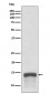 Anti-S100A9 Rabbit Monoclonal Antibody