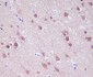Anti-PGP9.5 Rabbit Monoclonal Antibody