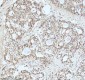 Anti-Drosha Rabbit Monoclonal Antibody