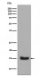 Anti-Midkine MDK Rabbit Monoclonal Antibody