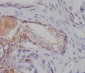 Anti-Tuberin TSC2 Rabbit Monoclonal Antibody