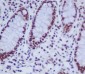 Anti-hnRNP K Rabbit Monoclonal Antibody