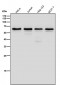 Anti-hnRNP K Rabbit Monoclonal Antibody